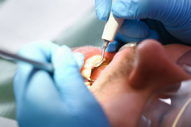 Best Weekend Emergency Dentist in Fairview, NC